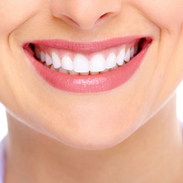 Free Take home whitening for life.
