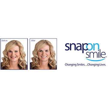 Snap-on Smile®