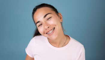 Do Clear Braces Improve Dental Health?