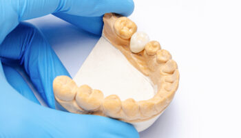What Are the Benefits of 3D Printing in Dentistry?