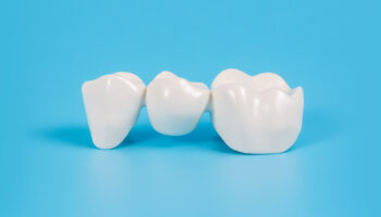 How Dental Bridges Prevent Oral Health Issues After Tooth Loss?